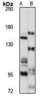 RAPTOR Rabbit Polyclonal Antibody