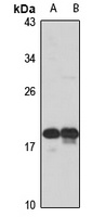 RSL24D1 Rabbit Polyclonal Antibody