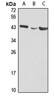 RSPO3 Rabbit Polyclonal Antibody