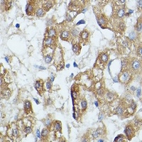 SAA4 Antibody