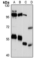 SAAL1 Rabbit Polyclonal Antibody