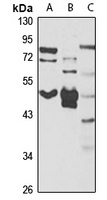 SAP30BP Rabbit Polyclonal Antibody