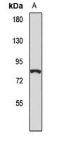 SATB2 Rabbit Polyclonal Antibody