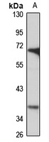 SCAMP2 Rabbit Polyclonal Antibody