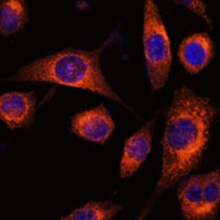 SCAMP2 Rabbit Polyclonal Antibody