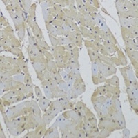 CD36 Rabbit Polyclonal Antibody