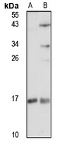 SDHAF2 Rabbit Polyclonal Antibody