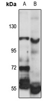 SEC16B Rabbit Polyclonal Antibody