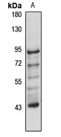 SEC23B Rabbit Polyclonal Antibody