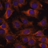 SEC23B Rabbit Polyclonal Antibody