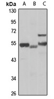 SLA/LP Rabbit Polyclonal Antibody