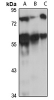 SERBP1 Rabbit Polyclonal Antibody