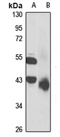 Serpin A7 Rabbit Polyclonal Antibody