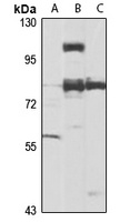 SETDB2 Antibody