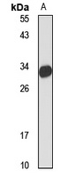 SARP3 Rabbit Polyclonal Antibody