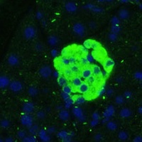 SARP3 Rabbit Polyclonal Antibody