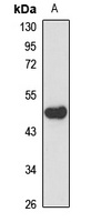 SMS1 Rabbit Polyclonal Antibody
