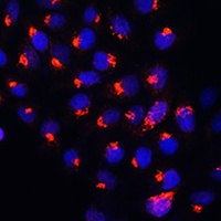 SMS1 Rabbit Polyclonal Antibody
