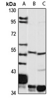 VMAT2 Antibody