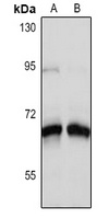 SLC18A3 Antibody