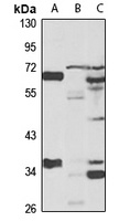 SLC23A2 Rabbit Polyclonal Antibody
