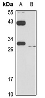 SLC31A1 Antibody