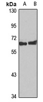 SLC38A3 Rabbit Polyclonal Antibody