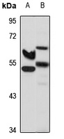 SLC39A8 Rabbit Polyclonal Antibody