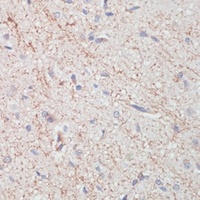 Dopamine Transporter Antibody