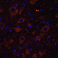 Dopamine Transporter Antibody