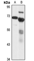 SERT Rabbit Polyclonal Antibody