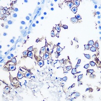 SERT Rabbit Polyclonal Antibody