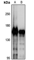 SMC4 Rabbit Polyclonal Antibody
