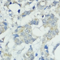 SOCS5 Antibody