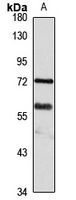 Spartan Rabbit Polyclonal Antibody