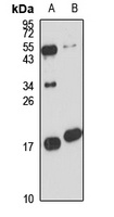 SRP14 Rabbit Polyclonal Antibody