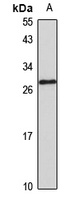 SC35 Rabbit Polyclonal Antibody