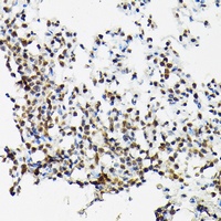 SC35 Rabbit Polyclonal Antibody