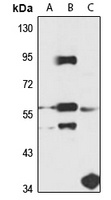 SS18L1 Rabbit Polyclonal Antibody