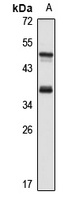 TRAP-alpha Rabbit Polyclonal Antibody
