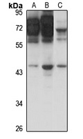 SSTR3 Rabbit Polyclonal Antibody