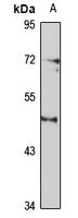 SSTR5 Rabbit Polyclonal Antibody