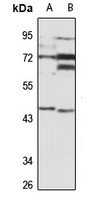 ILPIP Rabbit Polyclonal Antibody