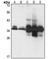 SUCLG1 Rabbit Polyclonal Antibody