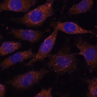 SUCLG1 Rabbit Polyclonal Antibody