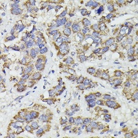 SUCLG2 Antibody