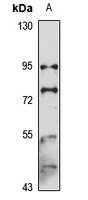 SUN1 Rabbit Polyclonal Antibody
