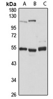 TADA3L Rabbit Polyclonal Antibody