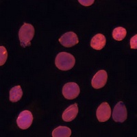 TADA3L Rabbit Polyclonal Antibody