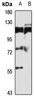 TBC1D15 Antibody